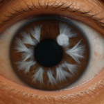 Find Cortical Cataracts treatment in Pune